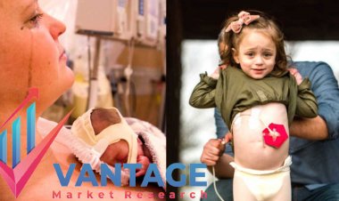 Top Companies in the Short Bowel Syndrome Market Is Essential for Your Success. Read this to find out why