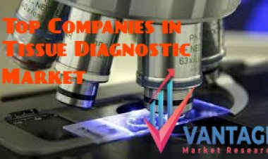Top Companies in Tissue Diagnostic Market; Read this and Improve Your Organization