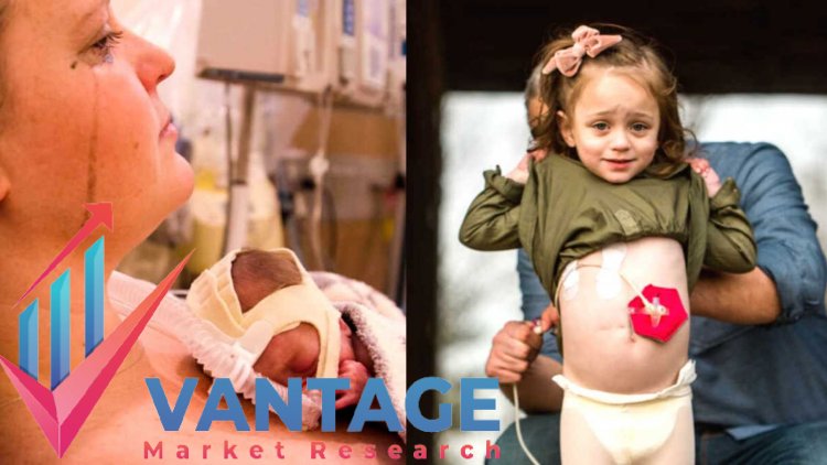 Top Companies in the Short Bowel Syndrome Market Is Essential for Your Success. Read this to find out why