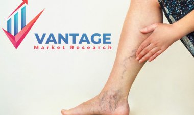 Top Companies in Varicose Veins Treatment Market | Major Players of Industry In-depth Analysis, Market insights, Competitive Analysis, | Vantage Market Research
