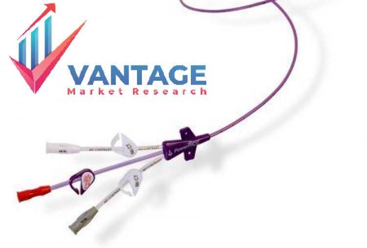 Top Companies in Contrast Injection Lines Market | Top Key Players Statistics, Market Insights, Comprehensive Analysis, Upcoming Opportunities |Vantage Market Research