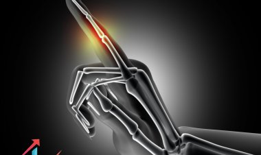 Top Companies in Bone Graft Substitutes Market | In-depth Research Report Offering Key Insights, Statistics, Future Scope, Emerging Opportunities | Vantage Market Research