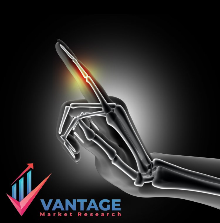 Top Companies in Bone Graft Substitutes Market | In-depth Research Report Offering Key Insights, Statistics, Future Scope, Emerging Opportunities | Vantage Market Research