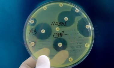 Lipid Nanodiscs Market Size to Reach $1.7 Billion at a CAGR of 7.7% by 2028