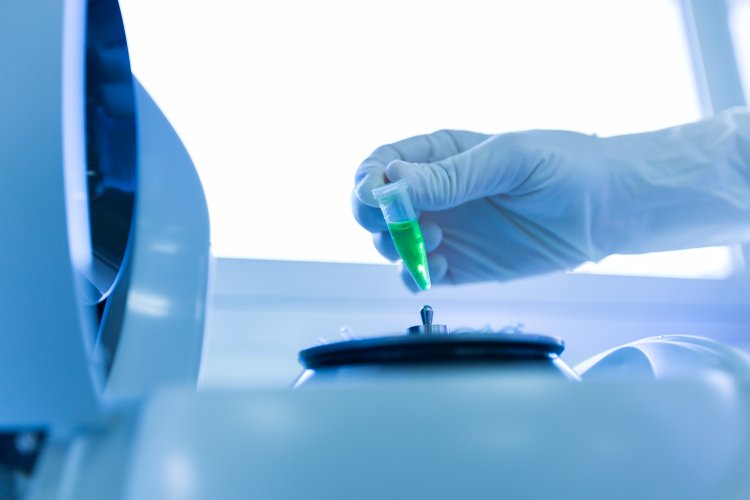 Liquid Biopsy Market Size to Reach $10.9 Billion at a CAGR of 17.8% by 2028