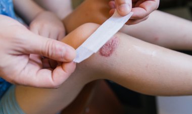 Top Companies in Anti-Biofilm Wound Dressing Market by Size, Share, Historical and Future Data & CAGR | Report by Vantage Market Research