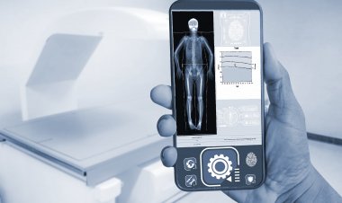 Global Smartphone Enabled Medical Devices Market Size to Reach $98.2 Billion at a CAGR of 16.3% by 2030
