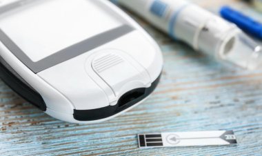 글로벌 HbA1c 검사 장비 시장 규모는 2030년까지 연평균 성장률 12.9%로 30억 3천만 달러에 도달할 전망