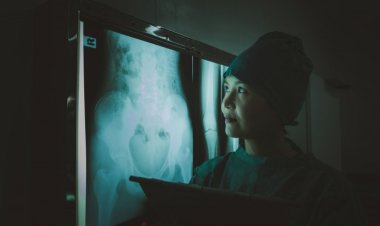 La taille du marché mondial de l'imagerie hyperspectrale médicale atteindra 3,1 milliards de dollars avec un TCAC de 13,5 % d'ici 2030