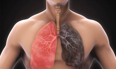 Global Chronic Obstructive Pulmonary Disease (COPD) Treatment Market Size, Share, Report 2032