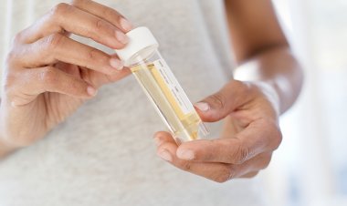 Albumin and Creatinine Tests Market Size, Analytical Overview, Growth Factors, Demand and Trends Forecast to 2032