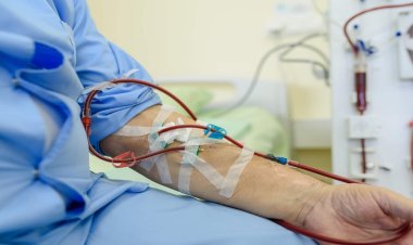 Exploring the Future of Dialysis: Key Trends and Innovations in Hemodialysis and Peritoneal Dialysis Market