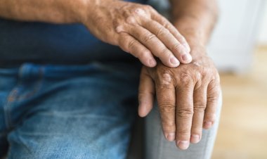 Psoriatic Arthritis Treatment Market | Trends & Growth Projections 2025