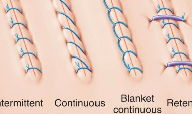 Surgical Sutures Market Size, Share & Trends Analysis Report 2025–2035